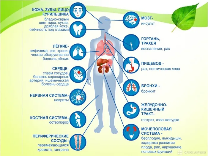 Слайд4