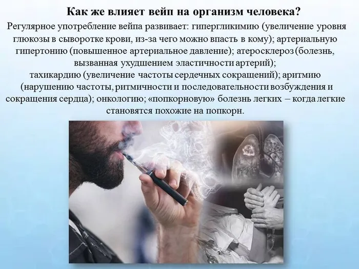 Слайд5